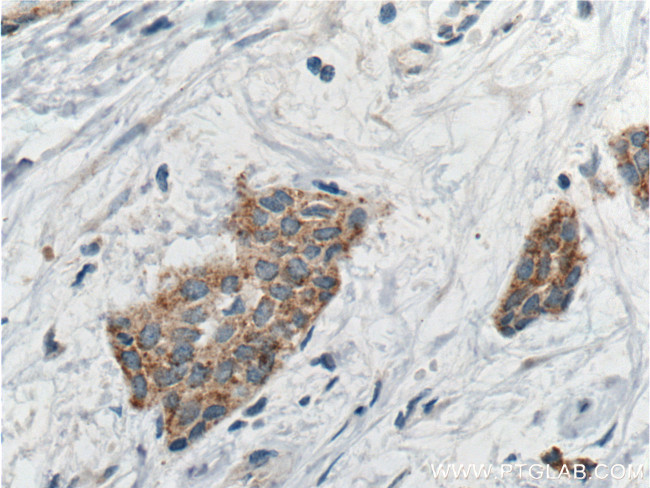 AGO2 Antibody in Immunohistochemistry (Paraffin) (IHC (P))