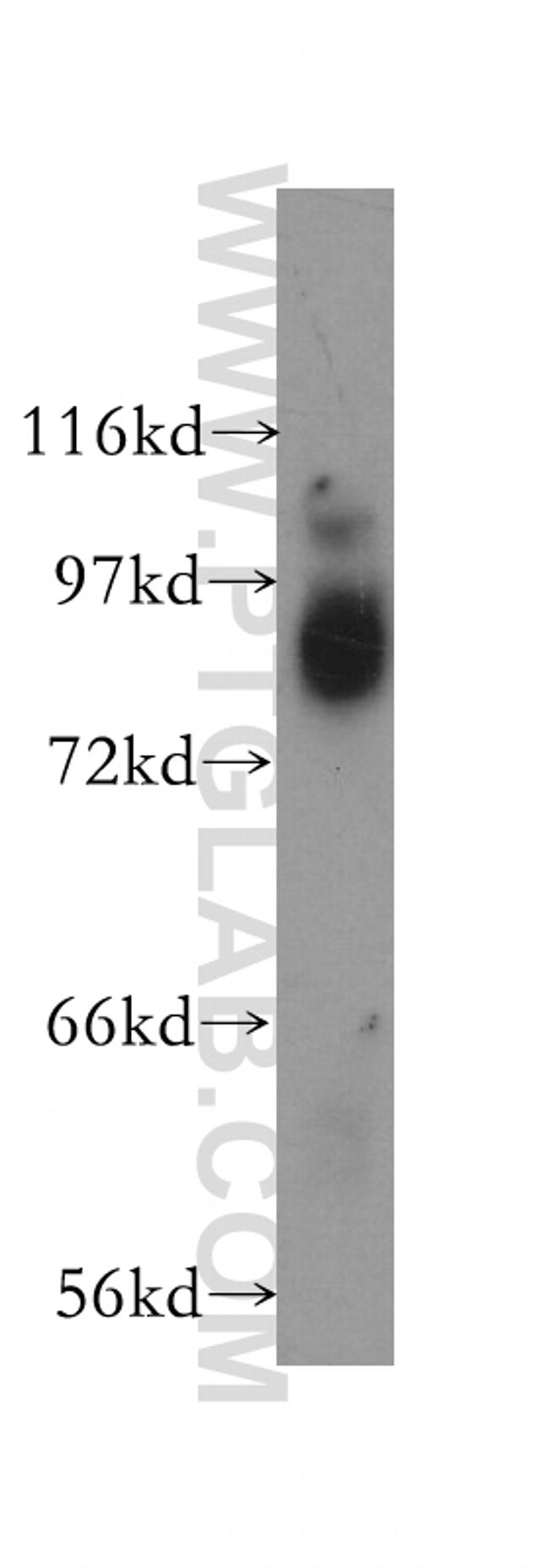 AGO2 Antibody in Western Blot (WB)