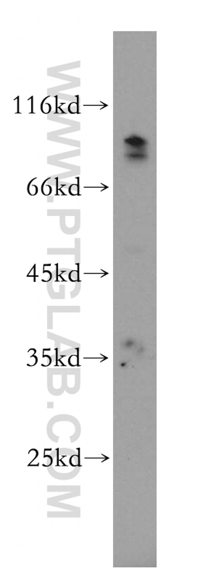 AGO2 Antibody in Western Blot (WB)