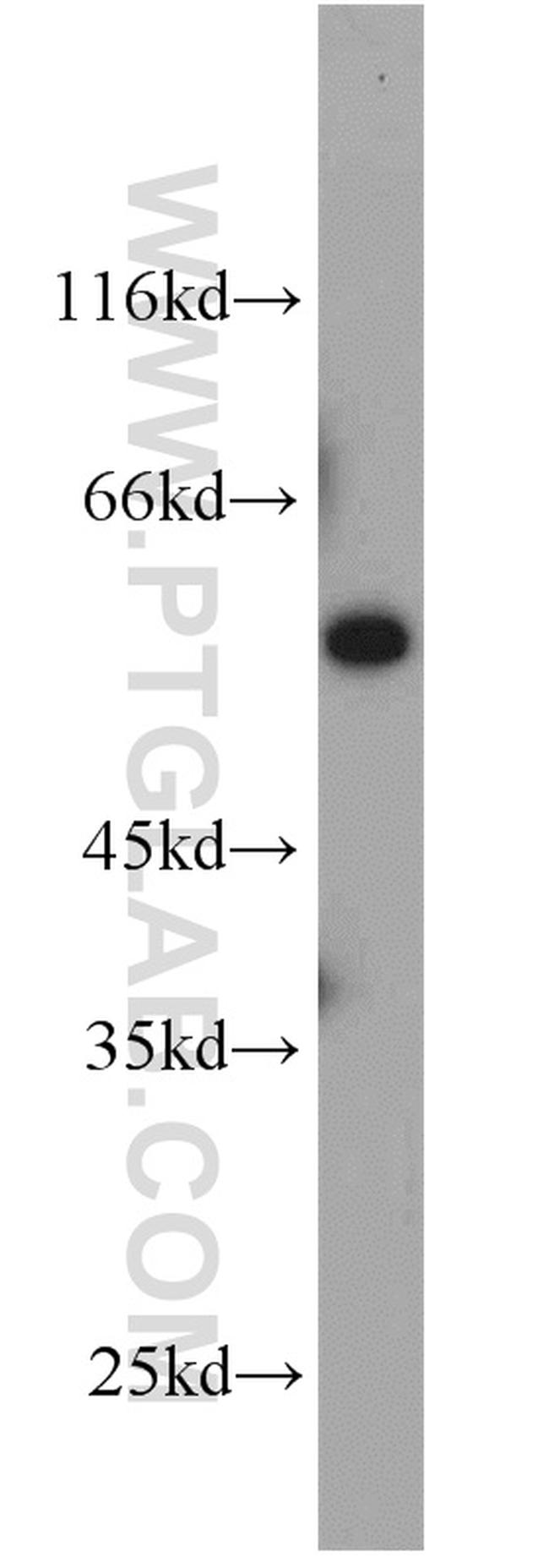 FBXO7 Antibody in Western Blot (WB)