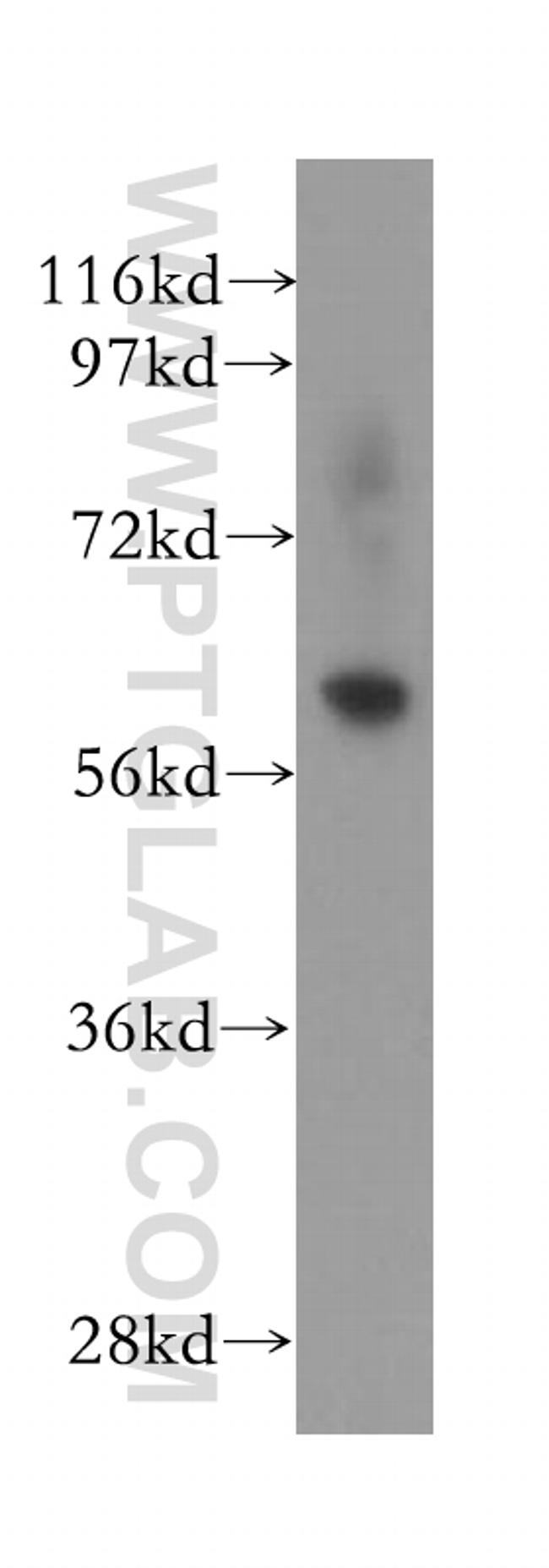 FBXO7 Antibody in Western Blot (WB)