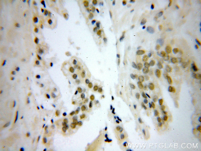 NELFE Antibody in Immunohistochemistry (Paraffin) (IHC (P))