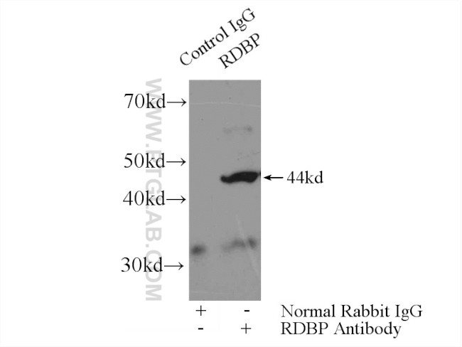 NELFE Antibody in Immunoprecipitation (IP)