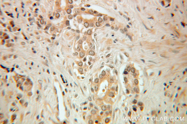 HSF2 Antibody in Immunohistochemistry (Paraffin) (IHC (P))