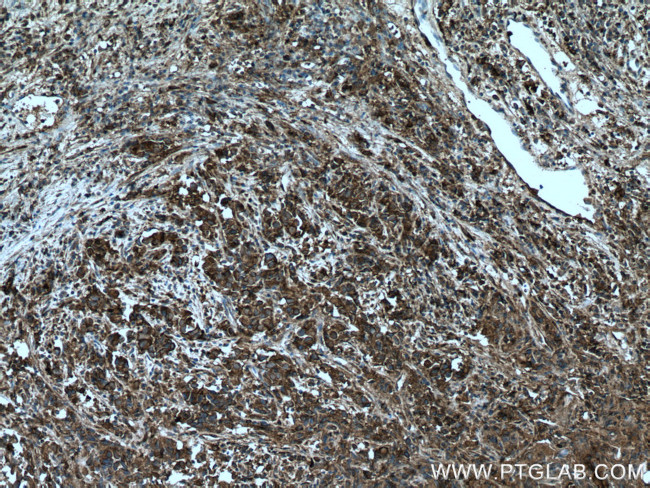 UBE2G2 Antibody in Immunohistochemistry (Paraffin) (IHC (P))