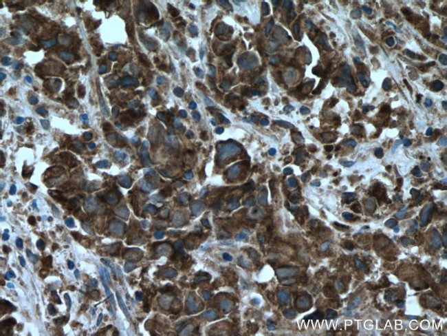 UBE2G2 Antibody in Immunohistochemistry (Paraffin) (IHC (P))