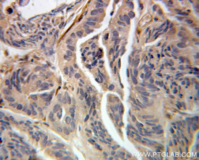 UBE2G2 Antibody in Immunohistochemistry (Paraffin) (IHC (P))