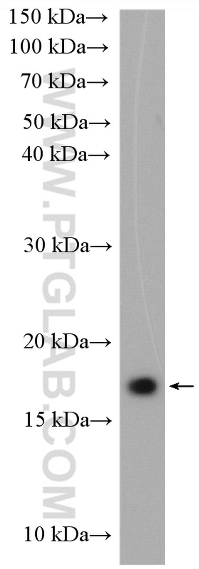 UBE2G2 Antibody in Western Blot (WB)