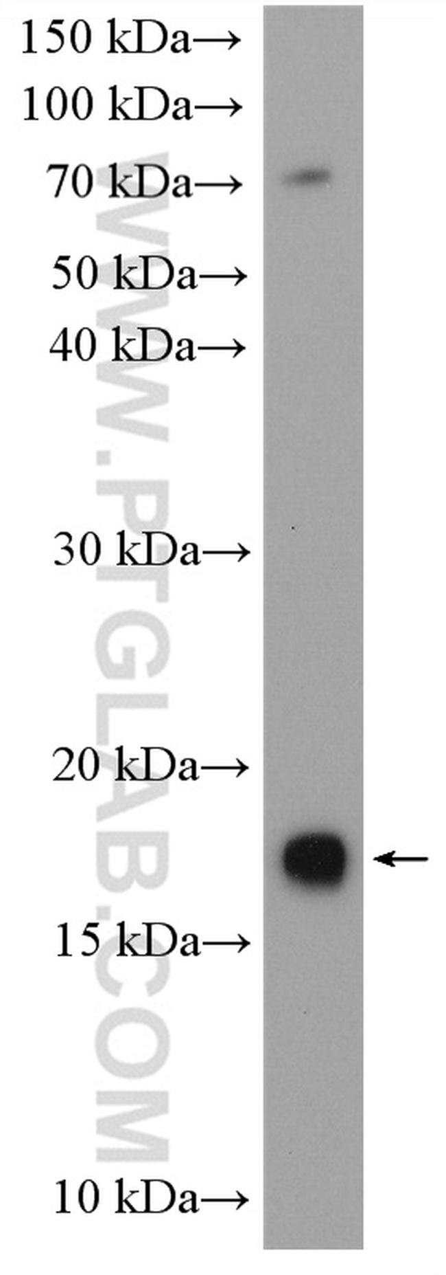 UBE2G2 Antibody in Western Blot (WB)