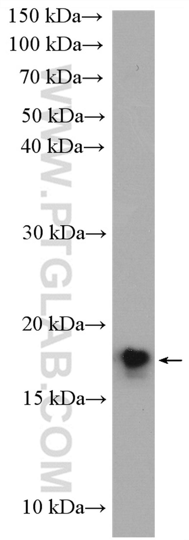 UBE2G2 Antibody in Western Blot (WB)