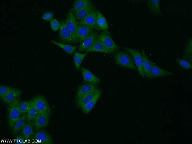 Ferritin light chain Antibody in Immunocytochemistry (ICC/IF)