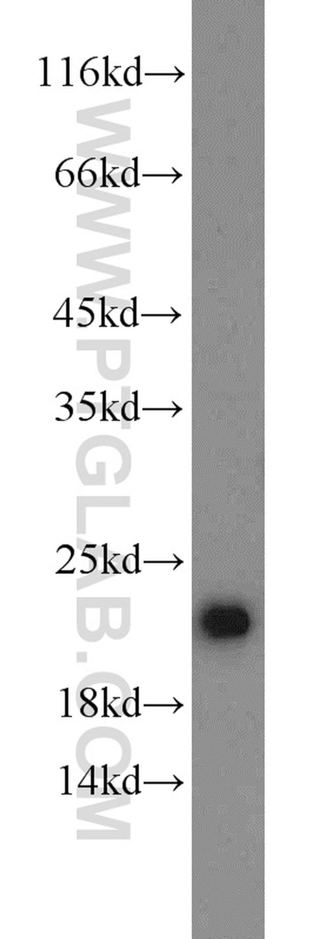 Ferritin light chain Antibody in Western Blot (WB)