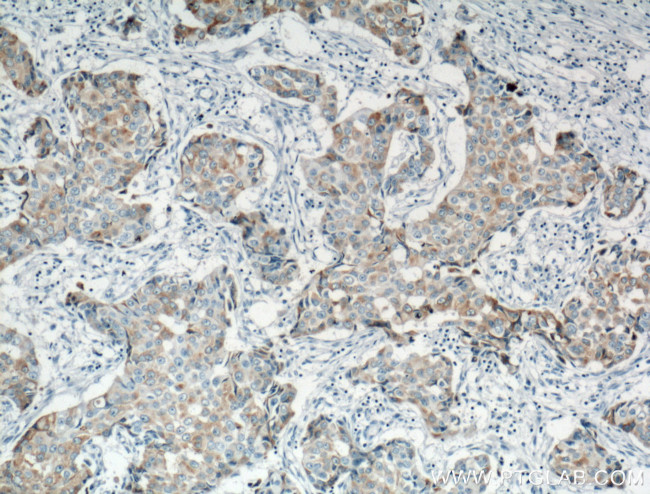 MGP Antibody in Immunohistochemistry (Paraffin) (IHC (P))