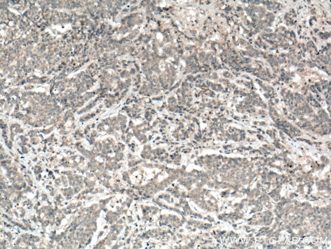 MGP Antibody in Immunohistochemistry (Paraffin) (IHC (P))