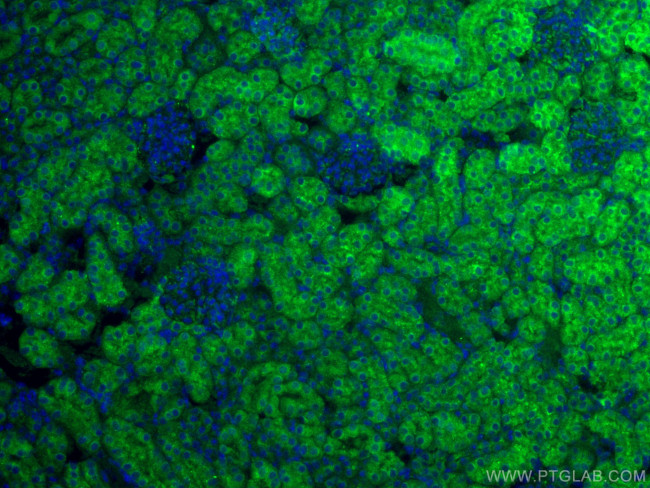 MGP Antibody in Immunohistochemistry (PFA fixed) (IHC (PFA))