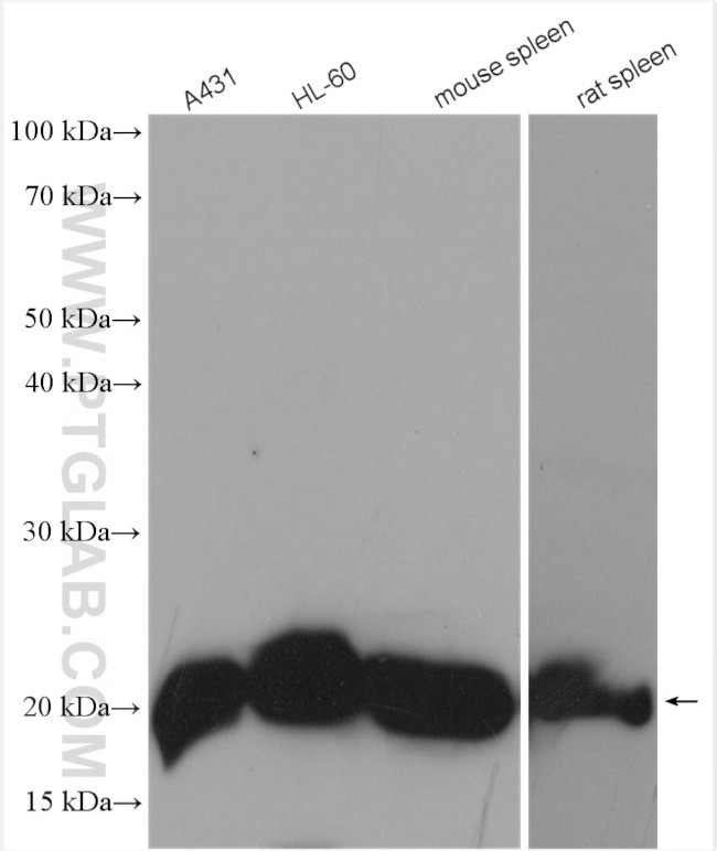 RAC2 Antibody in Western Blot (WB)