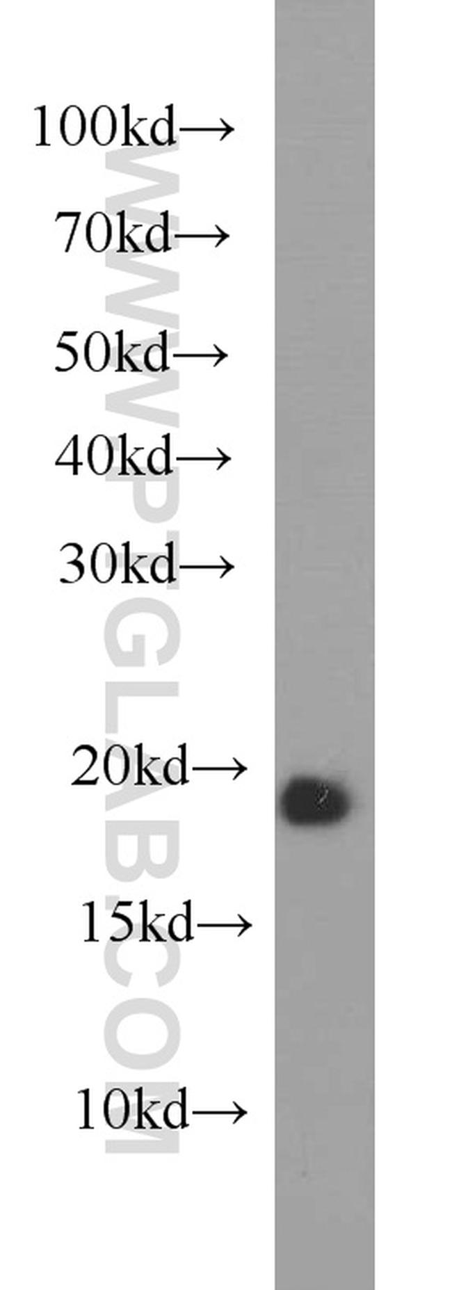 VAMP4 Antibody in Western Blot (WB)