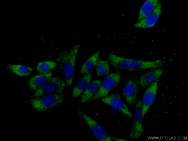 RHOA Antibody in Immunocytochemistry (ICC/IF)