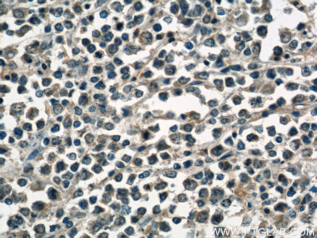 RHOA Antibody in Immunohistochemistry (Paraffin) (IHC (P))