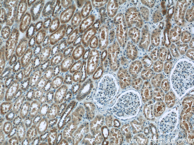 UQCRB Antibody in Immunohistochemistry (Paraffin) (IHC (P))