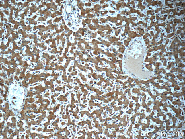 SND1 Antibody in Immunohistochemistry (Paraffin) (IHC (P))