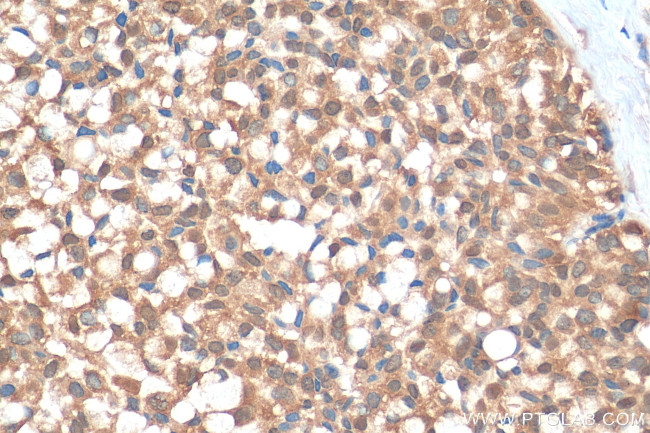 SND1 Antibody in Immunohistochemistry (Paraffin) (IHC (P))