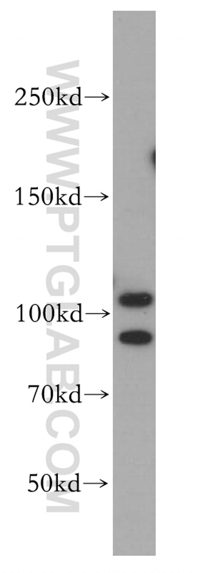 SND1 Antibody in Western Blot (WB)