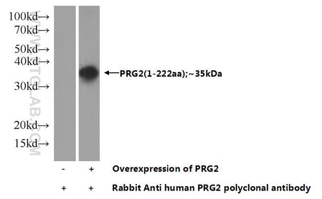 PRG2 Antibody in Western Blot (WB)