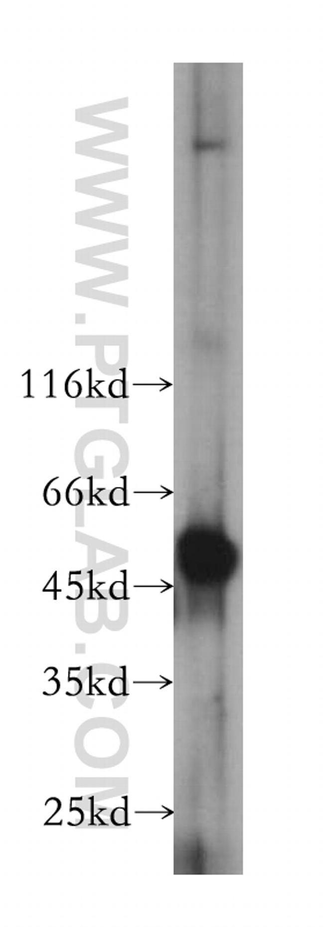 PRIM1 Antibody in Western Blot (WB)