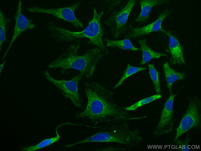 LDLR Antibody in Immunocytochemistry (ICC/IF)