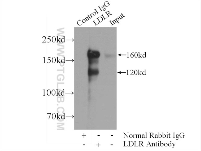 LDLR Antibody in Immunoprecipitation (IP)