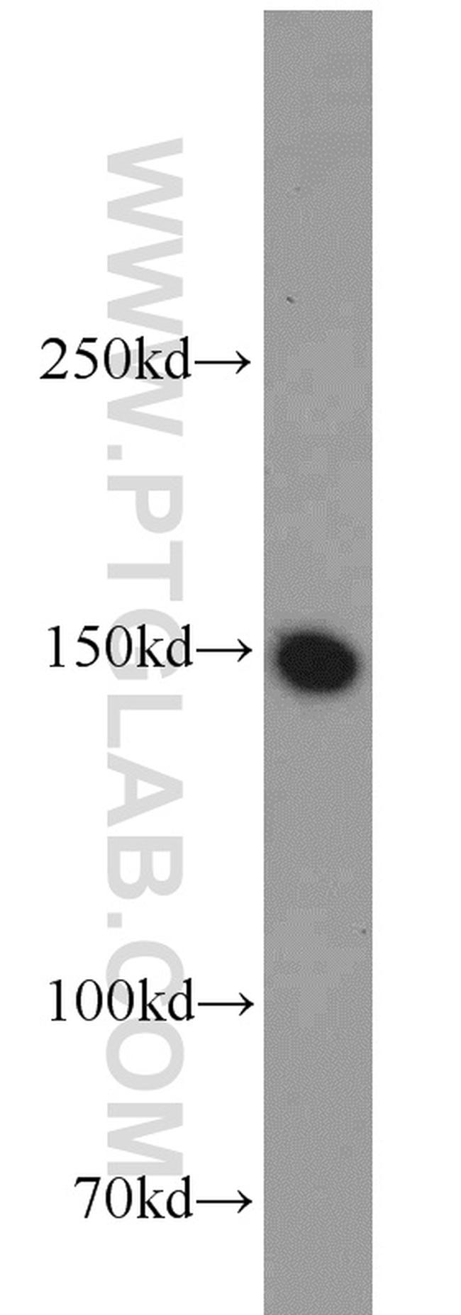 LDLR Antibody in Western Blot (WB)