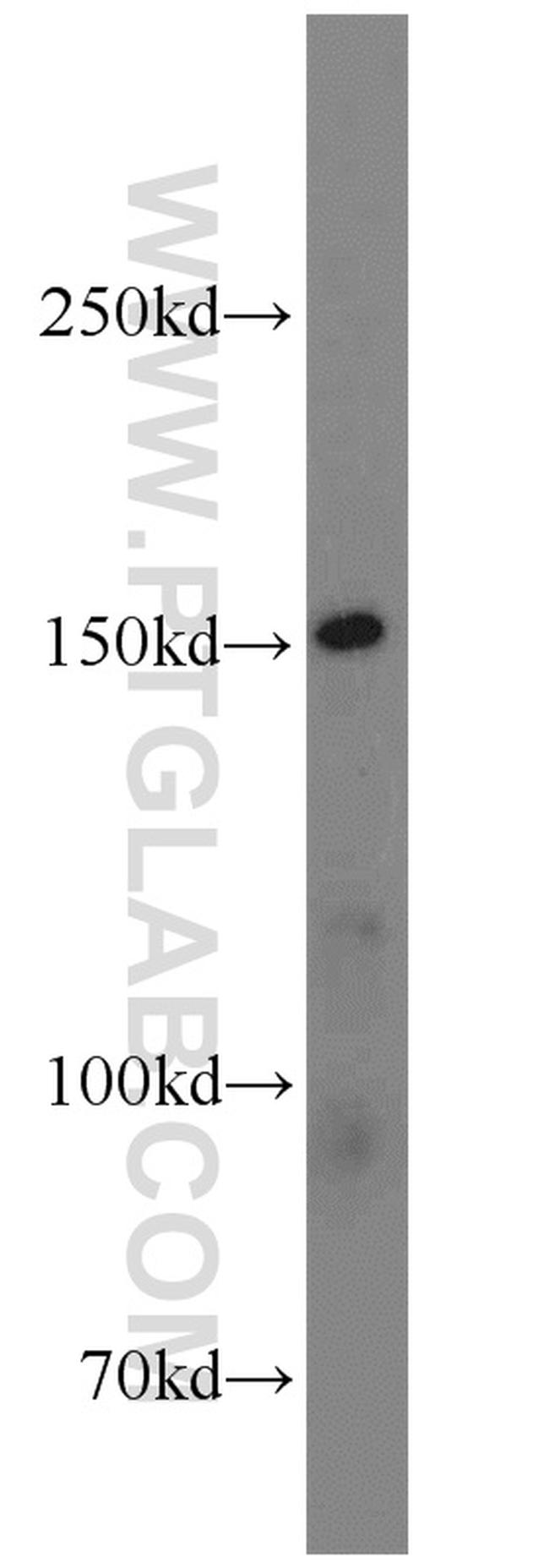 LDLR Antibody in Western Blot (WB)