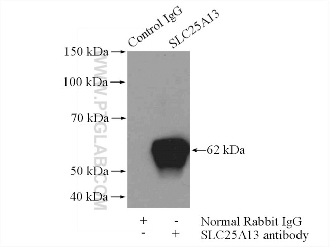 SLC25A13 Antibody in Immunoprecipitation (IP)