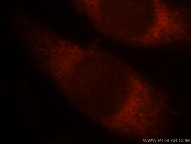 Sestrin 2 Antibody in Immunocytochemistry (ICC/IF)