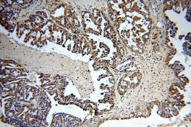 Sestrin 2 Antibody in Immunohistochemistry (Paraffin) (IHC (P))