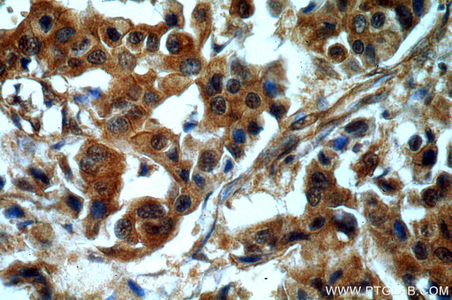 Sestrin 2 Antibody in Immunohistochemistry (Paraffin) (IHC (P))