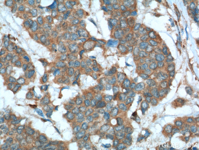 Sestrin 2 Antibody in Immunohistochemistry (Paraffin) (IHC (P))