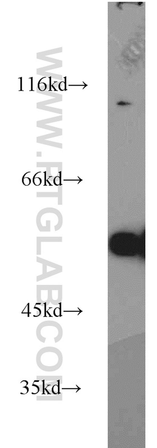 Sestrin 2 Antibody in Western Blot (WB)