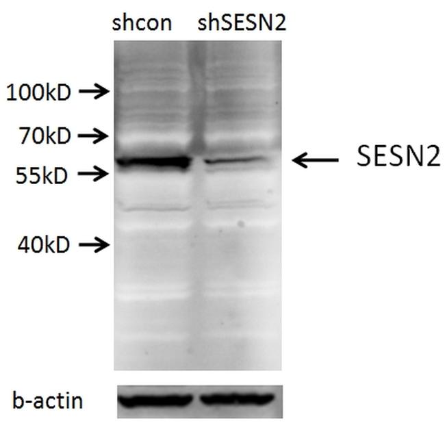 Sestrin 2 Antibody in Western Blot (WB)