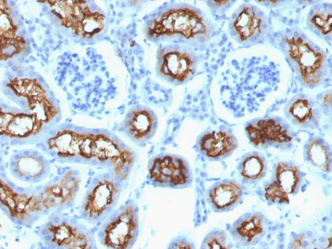 CFTR (Cystic Fibrosis Transmembrane Conductance Regulator) Antibody in Immunohistochemistry (Paraffin) (IHC (P))