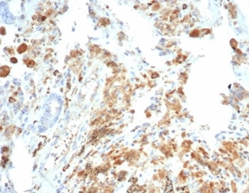 CFTR (Cystic Fibrosis Transmembrane Conductance Regulator) Antibody in Immunohistochemistry (Paraffin) (IHC (P))