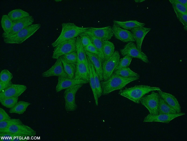 ARF3 Antibody in Immunocytochemistry (ICC/IF)