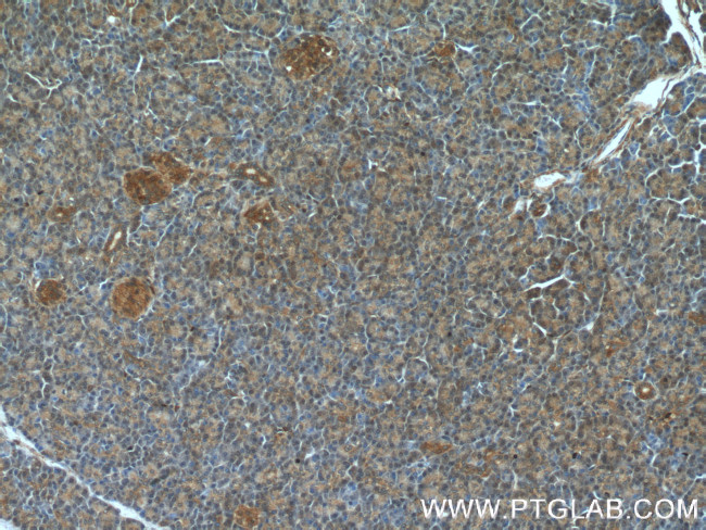 ARF3 Antibody in Immunohistochemistry (Paraffin) (IHC (P))