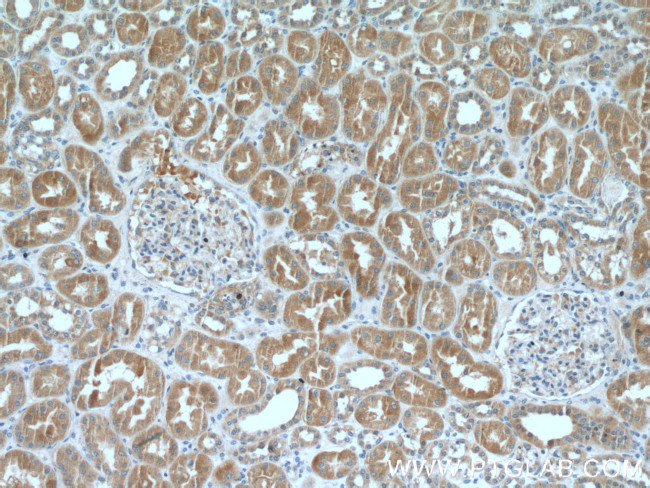 ARF3 Antibody in Immunohistochemistry (Paraffin) (IHC (P))