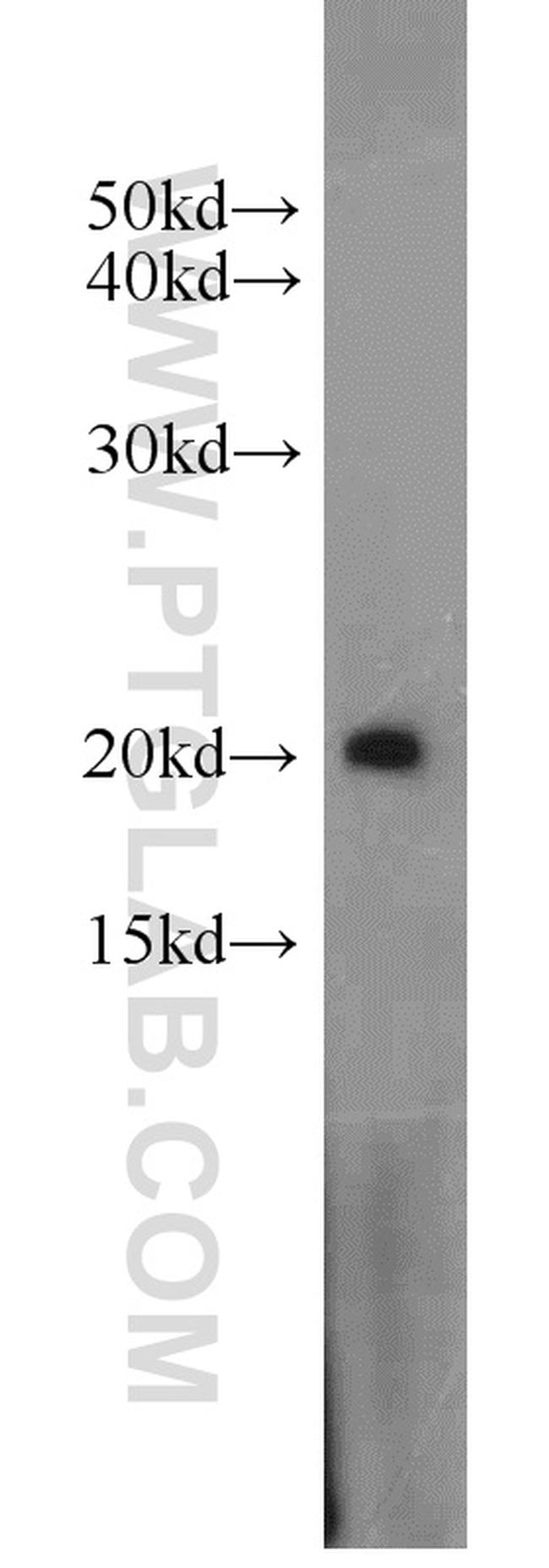 ARF3 Antibody in Western Blot (WB)