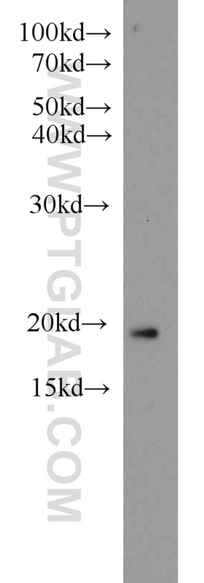 ARF3 Antibody in Western Blot (WB)