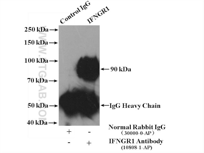 IFNGR1 Antibody in Immunoprecipitation (IP)