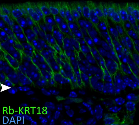 Cytokeratin 18 Antibody in Immunocytochemistry (ICC/IF)