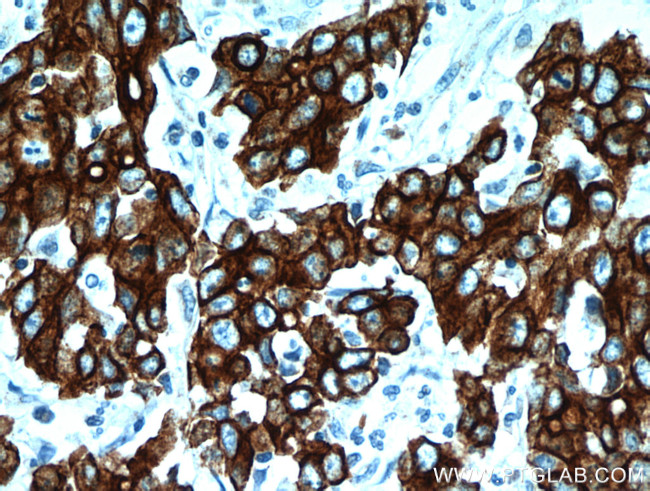 Cytokeratin 18 Antibody in Immunohistochemistry (Paraffin) (IHC (P))